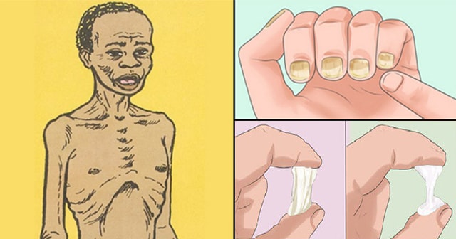 7 Warning Signs That You Might Be Infected by HIV Virus